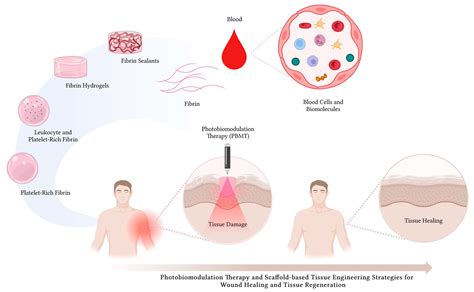 Fibrin – En revolutionerande biokompatibel matri för vävnadsrekonstruktion och regenerering!